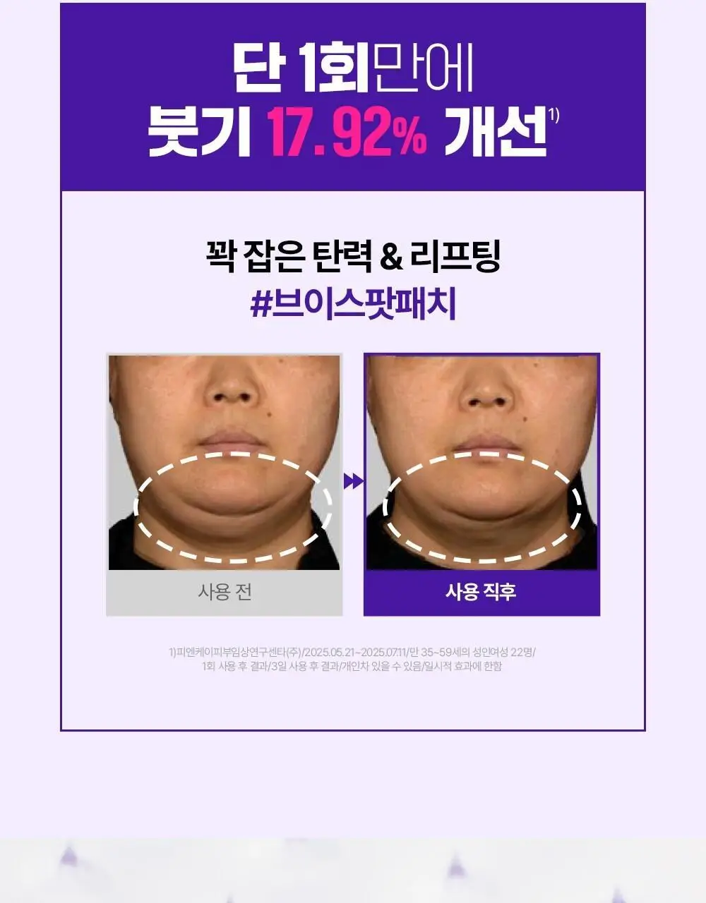 [탄력&리프팅 패치] 더마펌 스킨 텐션 리프팅 패치 500 (턱전용 4+2매) 상세페이지 5